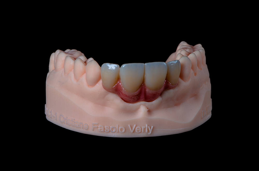 zirconia 01