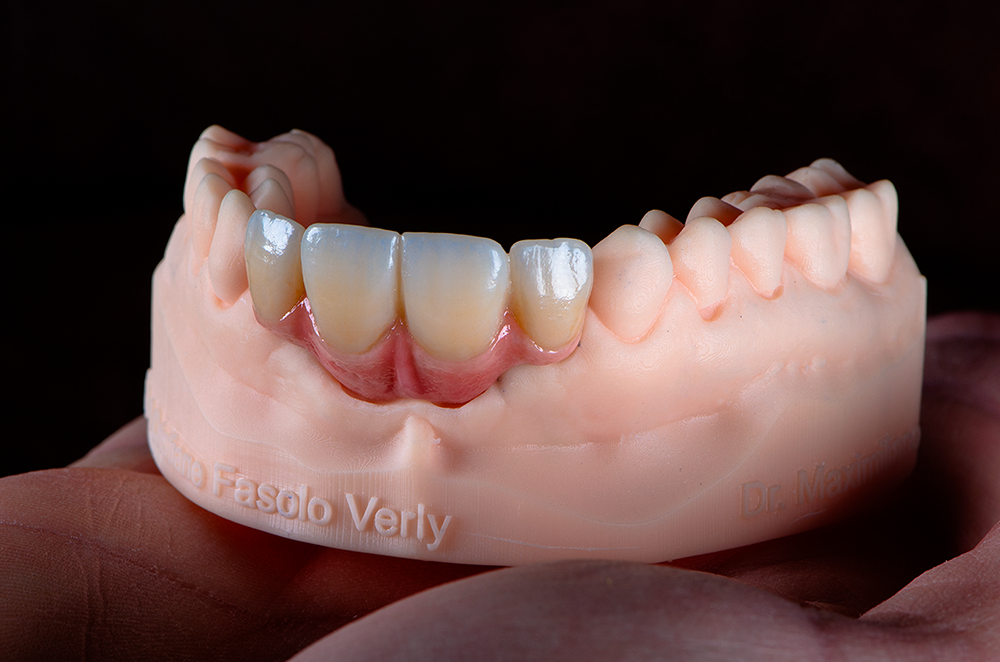 zirconia 02