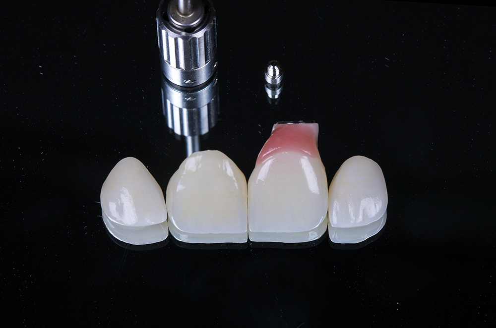 zirconia 04