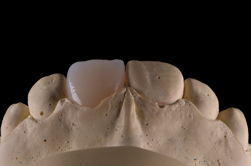 zirconia 07