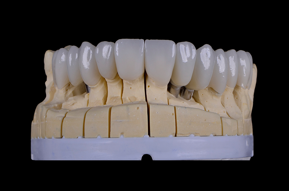 zirconia 08